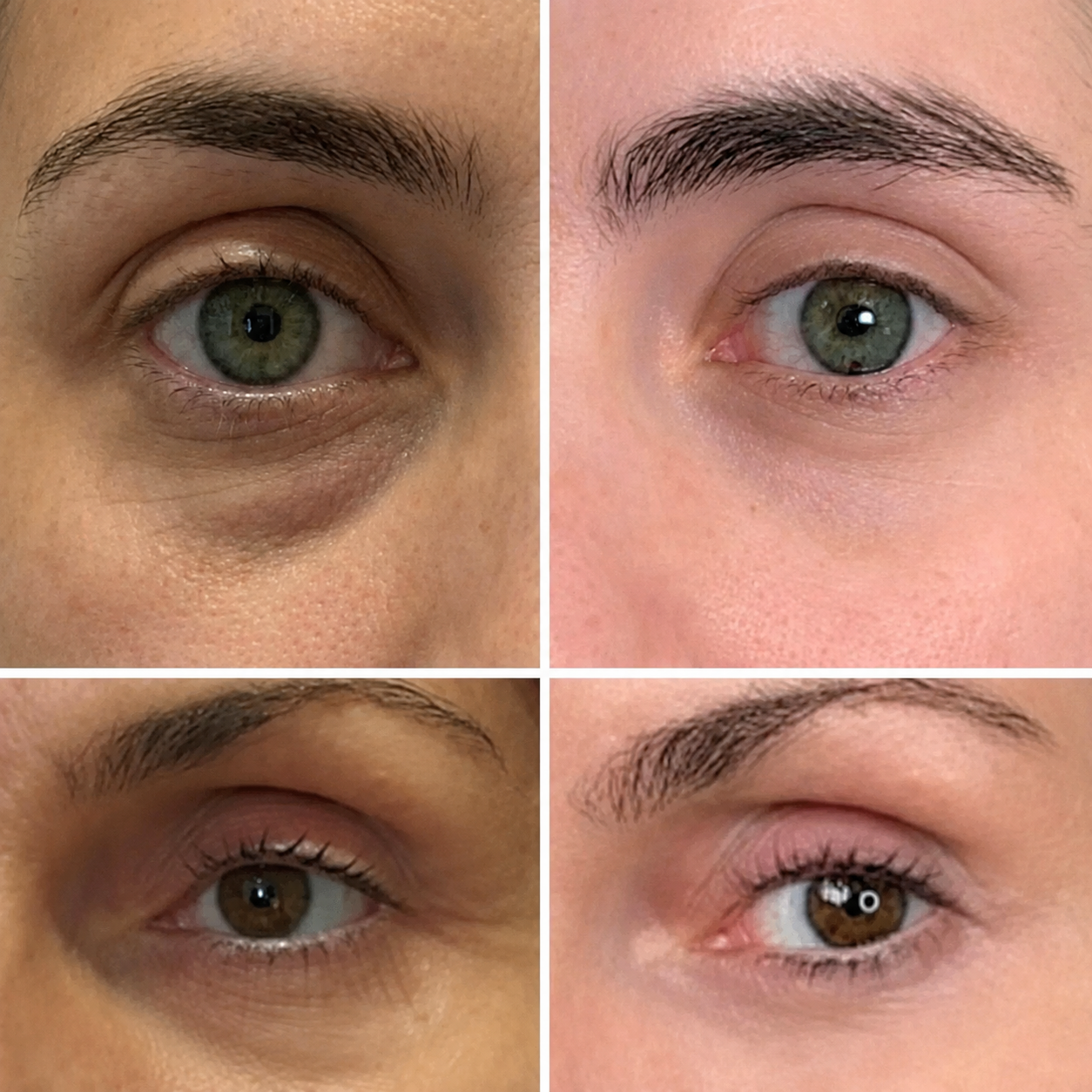 SheLoves™  PDRN Collagen Stick