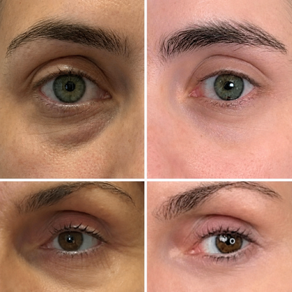 SheLoves™  PDRN Collagen Stick