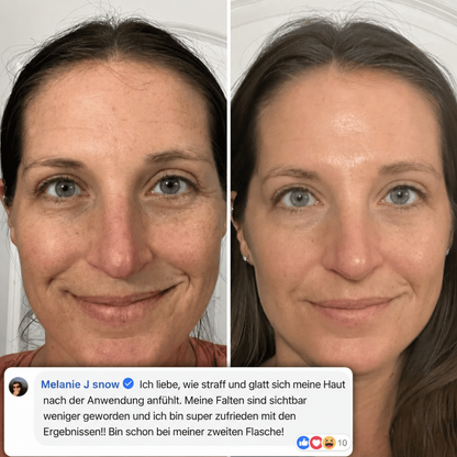 SheLoves™  PDRN Collagen Stick